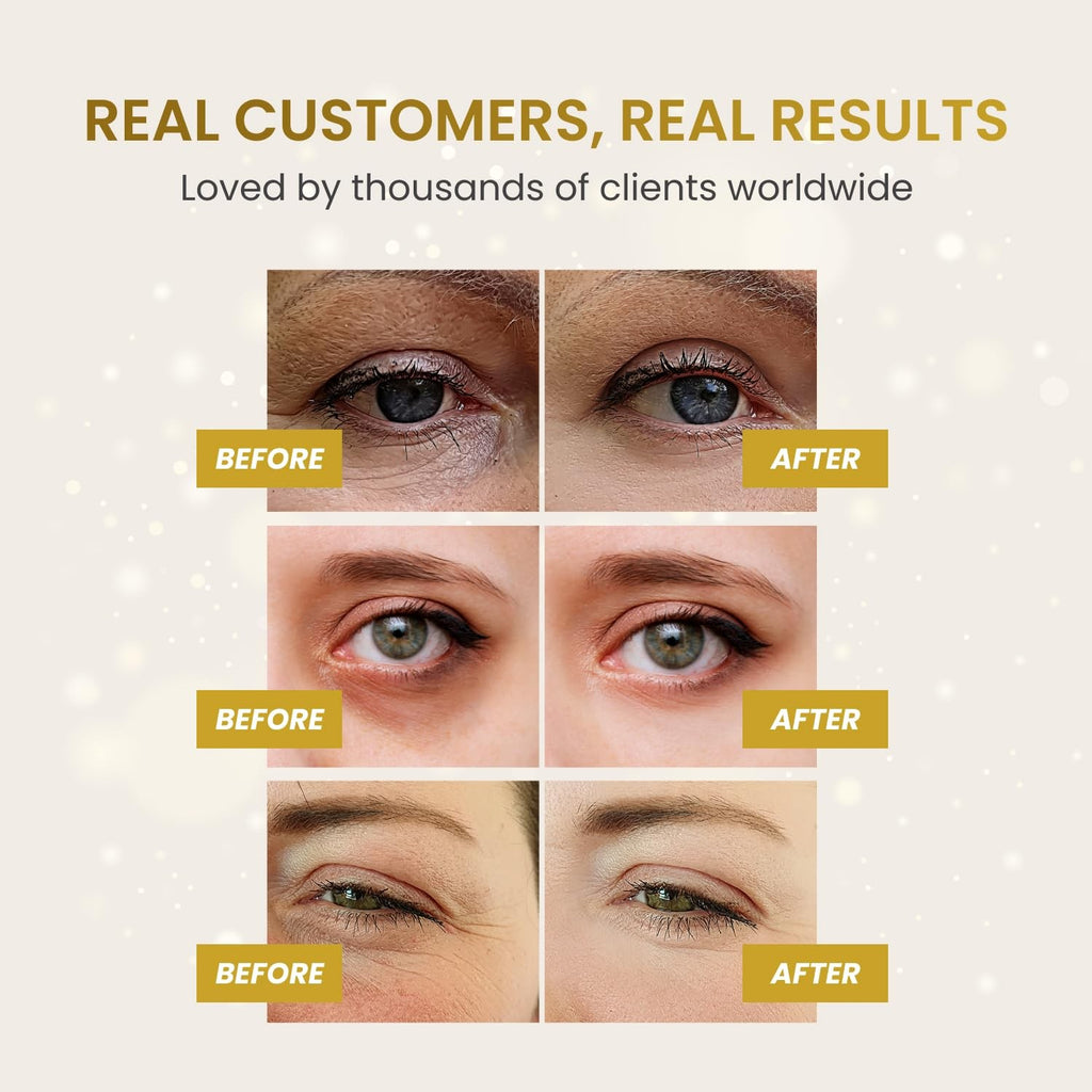 24K Gold Eye Patches Hydrating Collagen Masks Dark Circles Puffiness Skincare